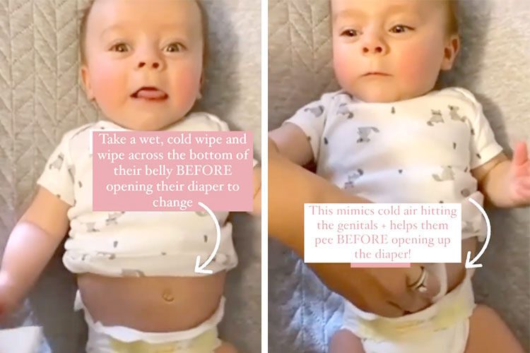 How to Stop Baby Boy Peeing When Changing Nappy
